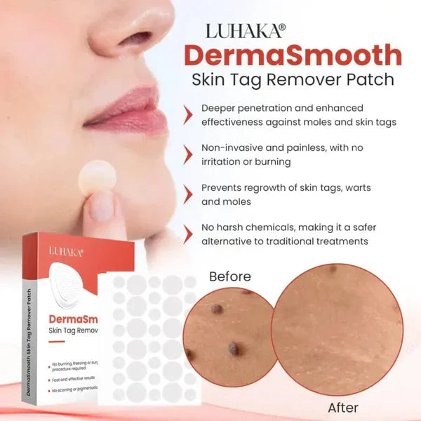 Derma Smooth Skin Tag Remover 72-Patches Natural and Fast Acting for Clear Skin Buy 2 And Get 1 Free